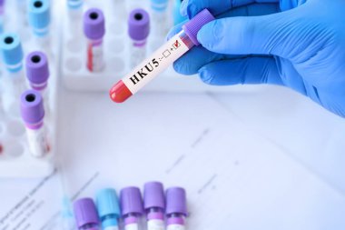 HKU5-CoV-2 virüs testi, elinde kan örneği tutan doktor. COVID-19 gibi Çin 'de Bat Coronavirus keşfi.