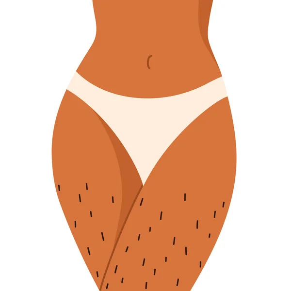 毛のない女性の足を剃る 体が正 女性の体毛を正規化 スキンケア 漫画風のベクトルイラスト 隔離された白い背景 — ストックベクタ