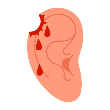Yaralı kulak. Kurşun deliği. Kan damlalarıyla yaralanmış insan kulağı. Kulak yaralanması ya da ağrı hissi. Düz biçim Vektör illüstrasyonu