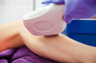 Doktor kozmetik uzmanı bir hastaya lazer cilt yenileme prosedürü uygular. Tıbbın arka planında fotokopi alanı var..