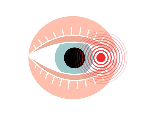 Symbolen För Mänsklig Ögonsmärta Ögonvärksikonen Vektorillustration Människokroppen Värker Smärta Punkt — Stock vektor