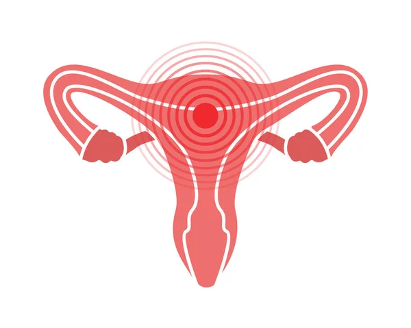 Mulher Símbolo Dor Sistema Reprodutivo Ícone Dor Sistema Reprodutivo Ilustração —  Vetores de Stock