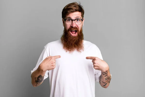 Dlouhé Vousy Zrzavé Vlasy Muž Cítí Šťastný Ukazuje Sebe Nadšením — Stock fotografie