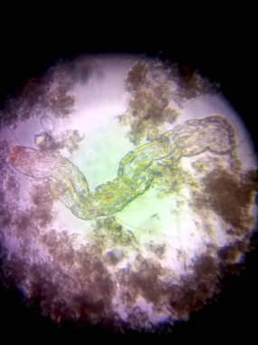 Yüksek büyütme altında, nematode mikropları organik maddelerle çevrili karmaşık yapıları ortaya çıkararak, ekosistemdeki biyolojik önemlerini vurgularlar..