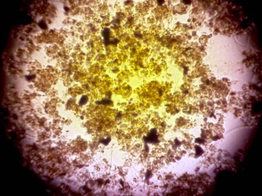 Mikroskop altında sayısız mikropun detaylı görüntüsünü yakalamak karmaşık şekilleri ve canlı renkleri ortaya çıkarıyor..