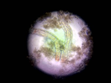 Mikroskop altında, nematode mikropları eşsiz şekillerini ve dokularını ortaya çıkararak, biyolojik çalışma ortamında detaylarını ve hareketlerini gösterirler..