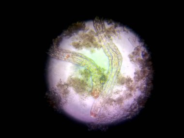 Nematode mikropları mikroskop altında incelenerek eşsiz yapılarını ve etkileşimlerini ortaya çıkarırlar. Bu gözlem, mikrobik çalışmaların vurgulandığı bir laboratuvarda gerçekleşir..