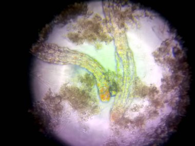 Nematodlar mikroskop altında incelenerek, uzamış vücutlarını ve eşsiz yapılarını organik materyallerin arka planına karşı sergiliyorlar..