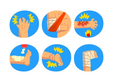 Mavi daire vektör setinde yaralı kol ve bacak için ilk yardım. İyileştirilmiş ve Bandajlanmış Fiziksel Uzuv Sakatlığı