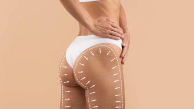 Anti-selülit tedavisi. Mükemmel kadın poposu, çizgileri ve okları kaldıran, beyaz külot giyen, kalçalarında dar deri olan, bej arka planda duran,