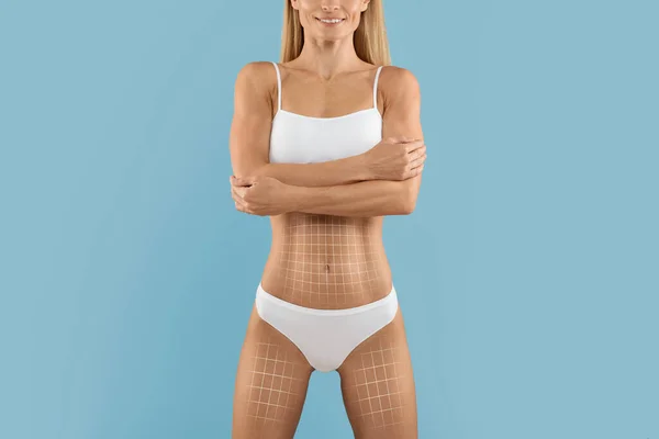 Çamaşırlı Ince Bir Kadın Vücuduna Çizgiler Çekiyor Sportif Figürlü Liposuction — Stok fotoğraf