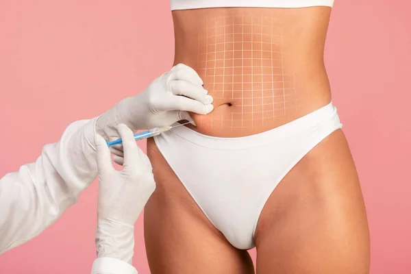 Kozmetikus Orvos Visel Kesztyűt Hogy Lypolisis Injekció Női Has Felismerhetetlen — Stock Fotó