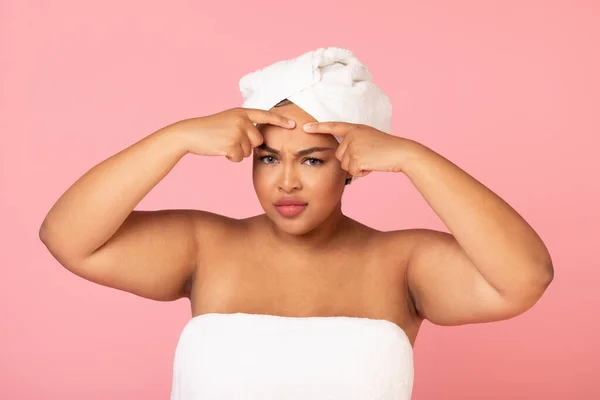 Problem Skin Black Body Positive Woman Popping Pimple Forehead While — Stock Photo, Image