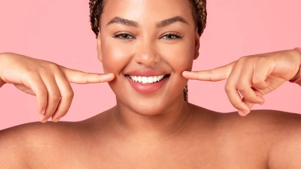 歯の配置とホワイトニングの概念 幸せな黒体の正の女性を指して彼女の広い笑顔で2本の額 ピンクの背景の上にポーズ クローズアップ パノラマ — ストック写真