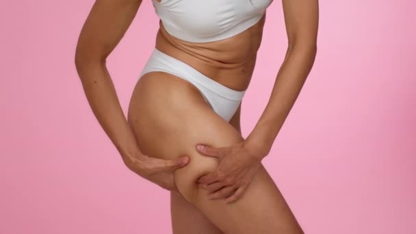 Orange Peel Effect Unrecognizable Woman Underwear Showing Cellulite Her Skin — Stok video