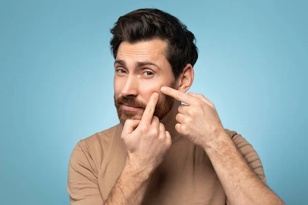 Portrait of bearded man touching his face, pressing pimple on face with fingers, looking at camera, blue studio background. Healthcare, stressful lifestyle hygienic acne concept