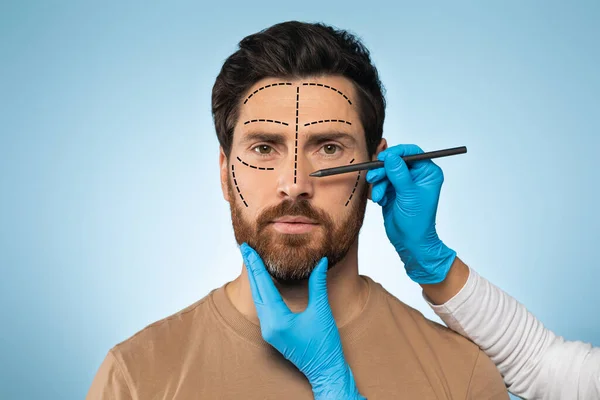 Plastic surgeon drawing marks on mans face for cosmetic surgery operation, handsome man posing on blue studio background, getting ready for aestetic operation or face lifting