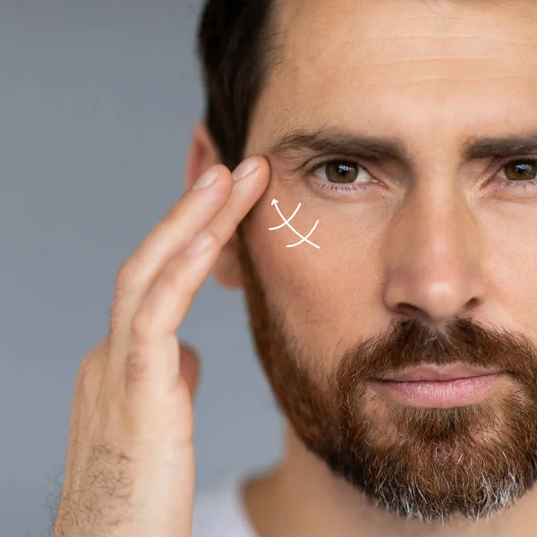 Close up portrait of middle aged bearded man, wanting to lift face to remove wrinkles and skin rejuvenation, using anti wrinkle creams or surgery, cropped