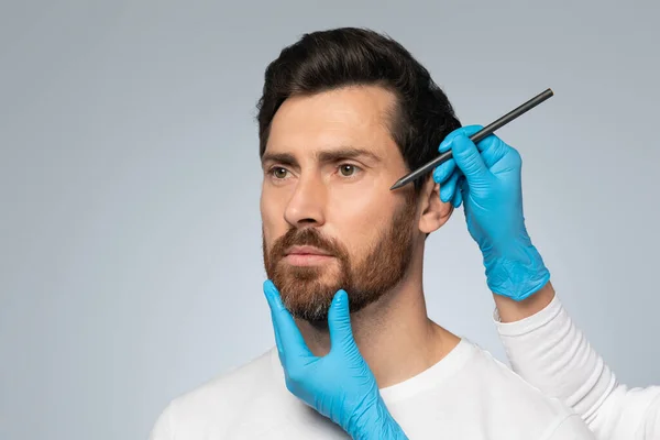 手術前に男性患者の顔の周りに黒いペンで輪郭を描く医療用手袋で整形外科医の手 中年ひげそりの男は美容治療を取得 — ストック写真
