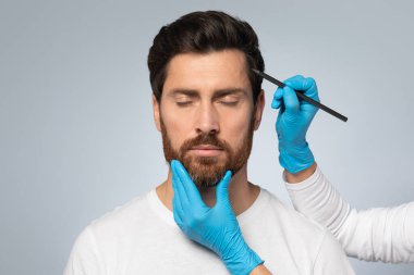 Orta yaşlı sakallı bir adam estetik kliniğe gidiyor estetik cerrah estetik ameliyattan önce erkek yüzünde iz bırakıyor güzellik prosedüründen önce, gri arka plan, fotokopi odası.