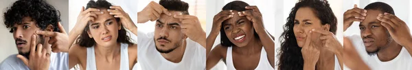 Problem Skin Diverse Multiethnic People Popping Pimples Forehead While Standing — Stock Photo, Image