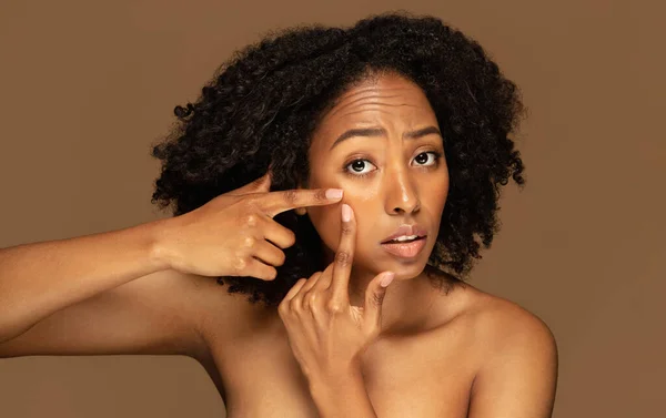 Condiciones Piel Ocnept Retrato Infeliz Triste Joven Hermosa Mujer Negra —  Fotos de Stock
