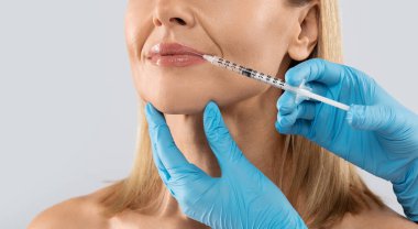 Sarışın, orta yaşlı bir kadın dudaklarına estetik iğne yaptırıyor. Yüz gençleştirme işlemi için Hyaluronik asit enjeksiyonu. Güzellik salonundaki kadınlar. Estetik cerrahi kliniği, kopyalama alanı
