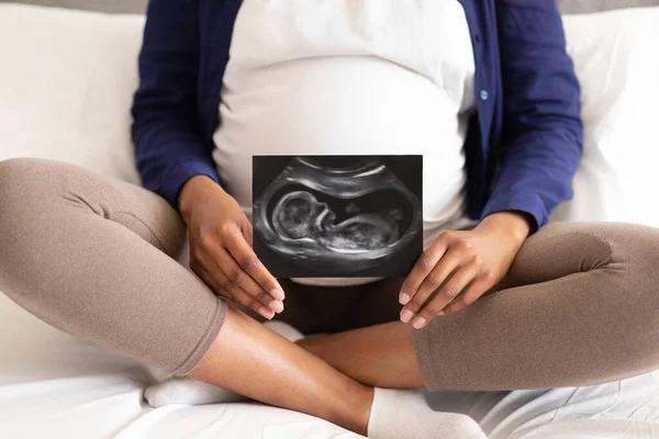 Millennial Black Woman Domestic Clothes Big Belly Shows Ultrasound Picture — Stock Photo, Image