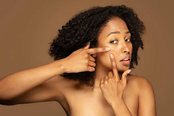 Concepto Condiciones Piel Primer Plano Joven Hermosa Mujer Negra Semidesnuda —  Fotos de Stock