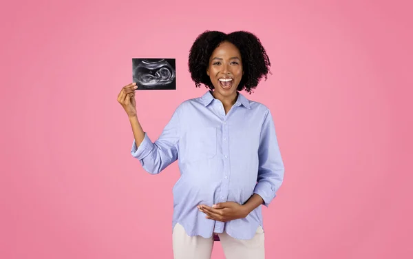 Glad Shocked Millennial African American Curly Pregnant Lady Open Mouth — Stock Photo, Image
