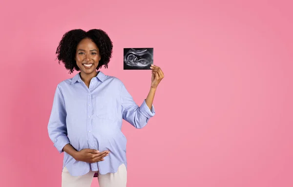 Glad Young Black Pregnant Lady Casual Touching Belly Enjoy Screening — Stock Photo, Image