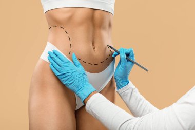 Doktor Estetik Cerrahi Operasyonundan Önce Kadın Vücudunda kesik çizgiler çiziyor, Tanınmayan İç Çamaşırlı Genç Kadın Estetik Liposculing Tedavisine Hazırlanıyor, Yaratıcı Kolaj