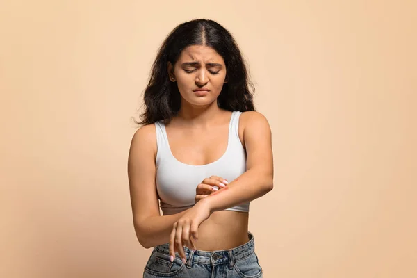 Skin Disorders. Young indian woman suffering eczema, scratching irritated skin on arm, upset eastern female having itching rash on body, standing isolated on beige studio background, copy space