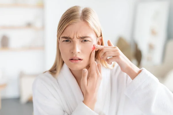 Acne Issue Unhappy Blonde Young Lady White Robe Looking Mirror — Stock Photo, Image