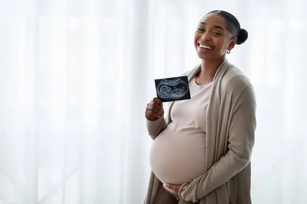 マタニティ コンセプト 幸せな美しい黒妊娠中の女性 彼女の赤ちゃんの超音波写真を保持し 自宅の窓の近くに立っている間 ベリーを緊張的に抱きしめている 期待する母親のソノグラフィースキャン — ストック写真
