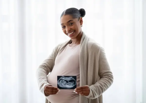 Cheerful Beautiful Young Pregnant African American Woman Standing Next Window — Stock Photo, Image