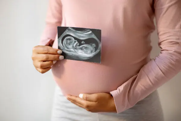Unrecognizable Black Pregnant Lady Demonstrating Her Baby Sonography Photo Young — Stock Photo, Image