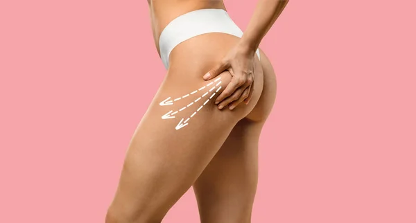 Cropped Slim Young Woman Underwear Doing Cellulite Massage Leg Isolated — Stock Photo, Image