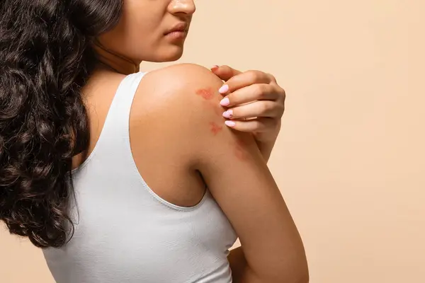 Mujer Joven Infeliz Que Rasca Piel Irritada Brazo Mujer India —  Fotos de Stock