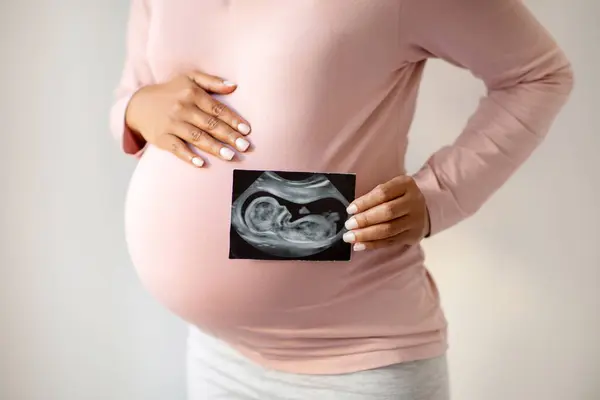 Těhotná Žena Láskyplně Ukazuje Své Ultrazvukové Fotografie Něžně Objímající Břicho — Stock fotografie