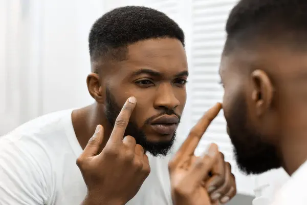 Hombre Afroamericano Examina Cuidadosamente Cara Espejo Tal Vez Preocupado Por — Foto de Stock