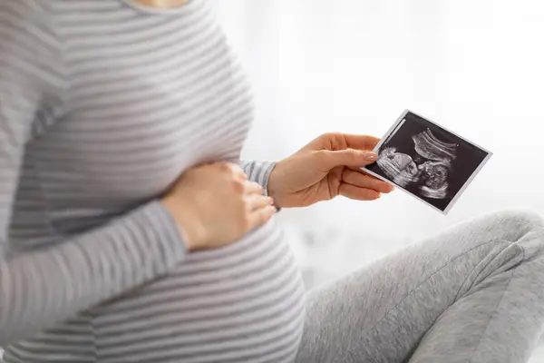 stock image A european pregnant lady at home, holding a sonogram, feeling the joy of her upcoming motherhood, capturing the beautiful journey of pregnancy