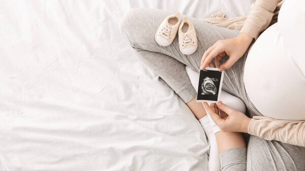 A pregnant woman is sitting cross-legged on a bed, holding an ultrasound picture, with baby shoes placed beside her, top view, copy space