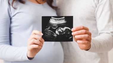 Yeni Yaşamın Doğuşu. Hamile kadın ve kocası, bebeklerinin ultrason taramasını gösteriyorlar. Ultrasonla ultrasona odaklanmış, ultrasonda ultrasona odaklanmış.