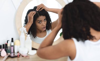 Kepek problemi. Üzgün siyah kadın aynada pullu kafa derisi ile saçlarına bakıyor, giyinme masasında oturuyor, omuzlarının üstünden bakıyor.