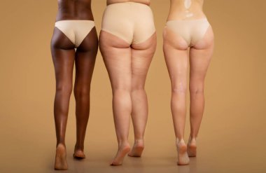 Farklı vücut tiplerine sahip üç kadının arka görünüşü, bej renkli stüdyo arka planında iç çamaşırlarıyla duran farklı etnik koşullara sahip kadınların bacakları, boş alanda kesilmiş görüntüler.
