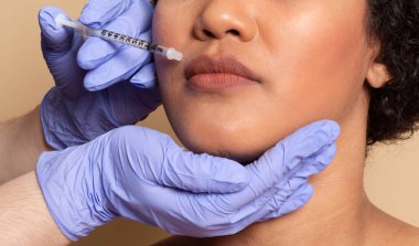 Bir güzellik uzmanı, temiz ve parlak bir klinikte bir kadının dudaklarına enjekte edilebilir bir tedavi uygular. Prosedür dikkatli yapıldığı için hasta rahatlamış görünüyor..