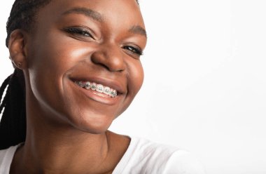 Diş teli takmış siyah bir kızın portresi beyaz arka planda kameraya gülümsüyor. Ortodonti Konsepti. Stüdyo Çekimi, Boş Alan