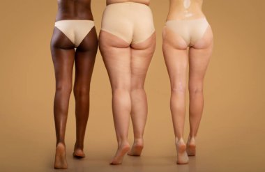 Farklı vücut tiplerine sahip üç kadının arka görünüşü, bej renkli stüdyo arka planında iç çamaşırlarıyla duran farklı etnik koşullara sahip kadınların bacakları, boş alanda kesilmiş görüntüler.