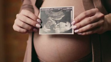 Müstakbel bir ebeveyn, yeni bir hayata kucak açmanın sevincini ve beklentisini yansıtırken ultrason resmini gururla sunar..